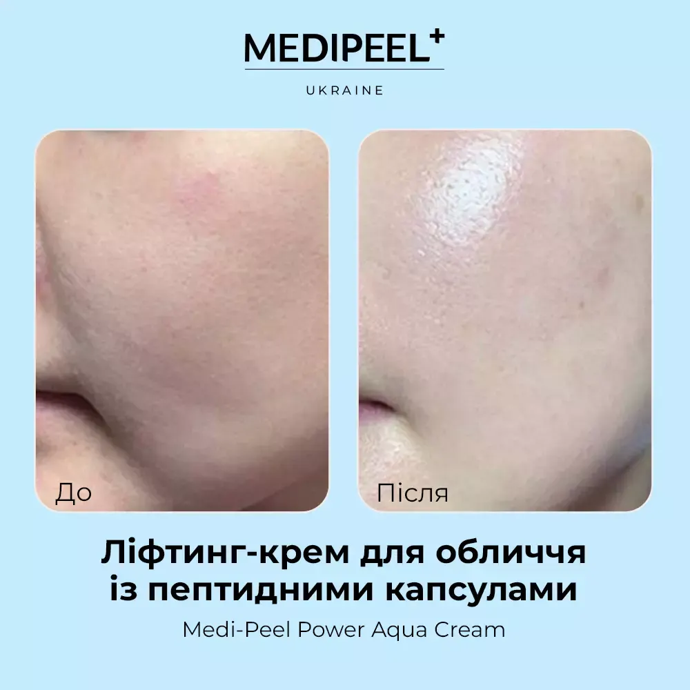 Ліфтинг-крем для обличчя із пептидними капсулами MEDIPEEL Power Aqua Cream, 50 мл — фото 3